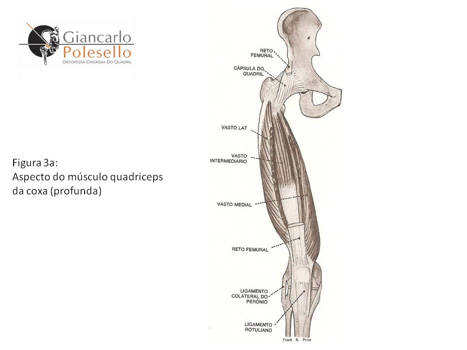 Aspecto do músculo quadríceps da coxa (profunda) 