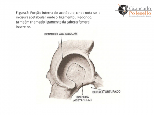 Porção interna do acetábulo, onde nota-se a inscisura acetabular, onde o ligamento, Redondo, também chamado ligamento da cabeça femoral insere-se.