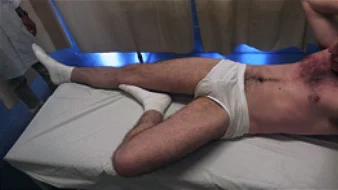 Fig. 1. Avaliação de possível causa de pubalgia que se trata de um desequilíbrio entre a musculatura adutora e retofemoral