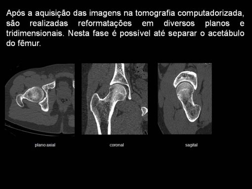 Tomografia Computadorizada 0620